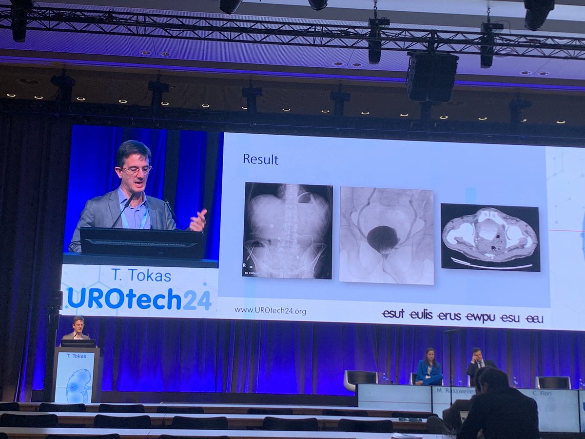Selçuk Güven (@selcukguven_8) on Twitter photo <a href="/TheodorosTokas/">Theodoros Tokas</a> , an exemplary friend, surgeon and academic, consistently delivers outstanding presentations, skillfully integrating cutting-edge technology. We are fortunate to have him. His expertise truly sets a benchmark.
<a href="/AliSerdarGozen/">AliSerdar Gözen</a>
<a href="/eauesut/">European Section of Uro-Technology (ESUT)</a> <a href="/Uroweb/">European Association of Urology (EAU)</a> #UROtech24 <a href="/TheodorosTokas/">Theodoros Tokas</a> , an exemplary friend, surgeon and academic, consistently delivers outstanding presentations, skillfully integrating cutting-edge technology. We are fortunate to have him. His expertise truly sets a benchmark.
<a href="/AliSerdarGozen/">AliSerdar Gözen</a>
<a href="/eauesut/">European Section of Uro-Technology (ESUT)</a> <a href="/Uroweb/">European Association of Urology (EAU)</a> #UROtech24