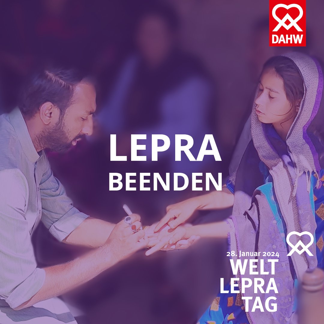 dahw_germany's tweet photo. Heute ist Welt-Lepra-Tag. Weltweit wird dabei auf eine Krankheit aufmerksam gemacht, die es seit Menschengedenken gibt und die in vielen Ländern der Erde immer noch eine große Herausforderung darstellt. Bleibt neugierig!
#WeltLepraTag2024 #ZeroLeprosyPakistan #DAHW #Leprabeenden https://t.co/KnXFZqp8ku