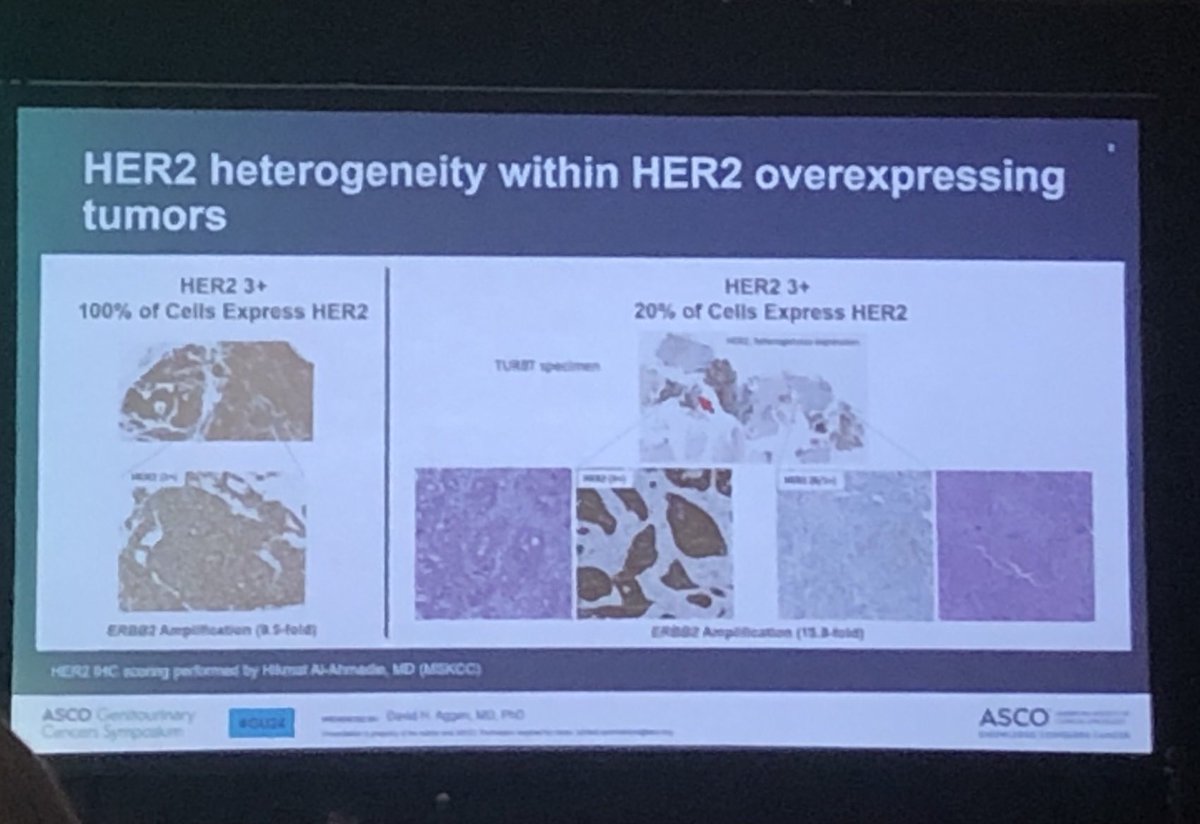 ⁦@Dr_Aggen⁩ from ⁦@MSKCancerCenter⁩ discussing HER2 expression pattern and heterogeneity in #bladdercancer #GU24 ⁦@DrRosenbergMSK⁩ ⁦@DSolit⁩ #GUPATH