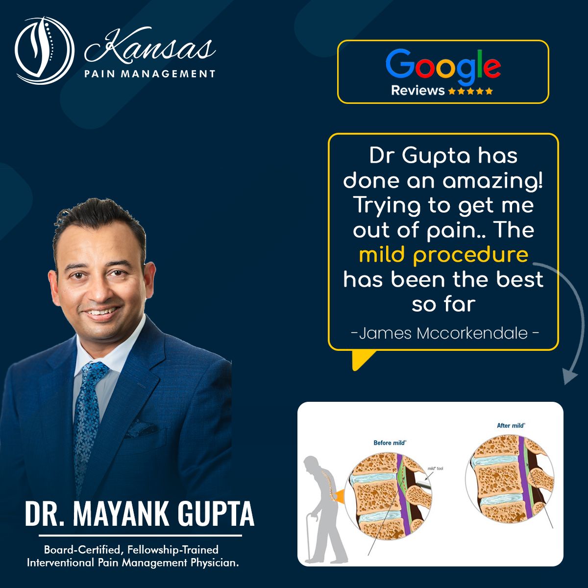 𝐏𝐚𝐭𝐢𝐞𝐧𝐭'𝐬 𝐓𝐞𝐬𝐭𝐢𝐦𝐨𝐧𝐢𝐚𝐥 - ⭐⭐⭐⭐⭐ 𝐆𝐨𝐨𝐠𝐥𝐞 𝐑𝐞𝐯𝐢𝐞𝐰𝐬
✅ Dr Gupta has done an amazing Job !
✅ Trying to get me out of pain.. The mild procedure has been the best so far
Thanks, James for your  your amazing review. Appreciate it.
#BestPainDoctor