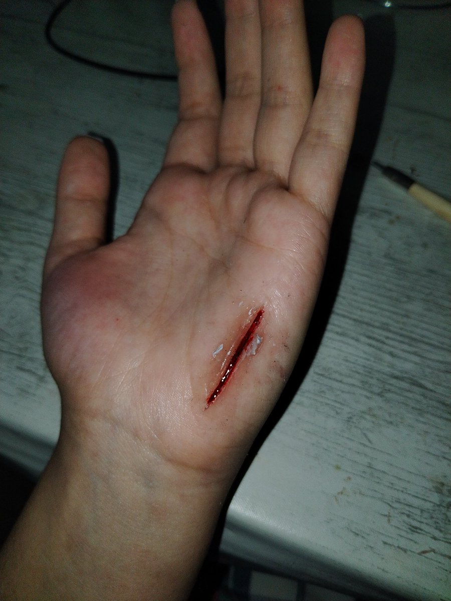 ❗FAKE MAKEUP❗
•
•
•
#sfx #sfxmakeup #Cinema #art #artist #special #specialeffects #fx #makeup #fake #wound #Blood #carcrash #fakemakeup #fakewound