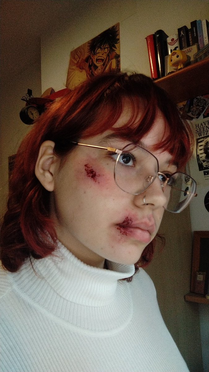 ❗FAKE MAKEUP❗
•
•
•
#sfx #sfxmakeup #Cinema #art #artist #special #specialeffects #fx #makeup #fake #wound #Blood #carcrash #fakemakeup #fakewound