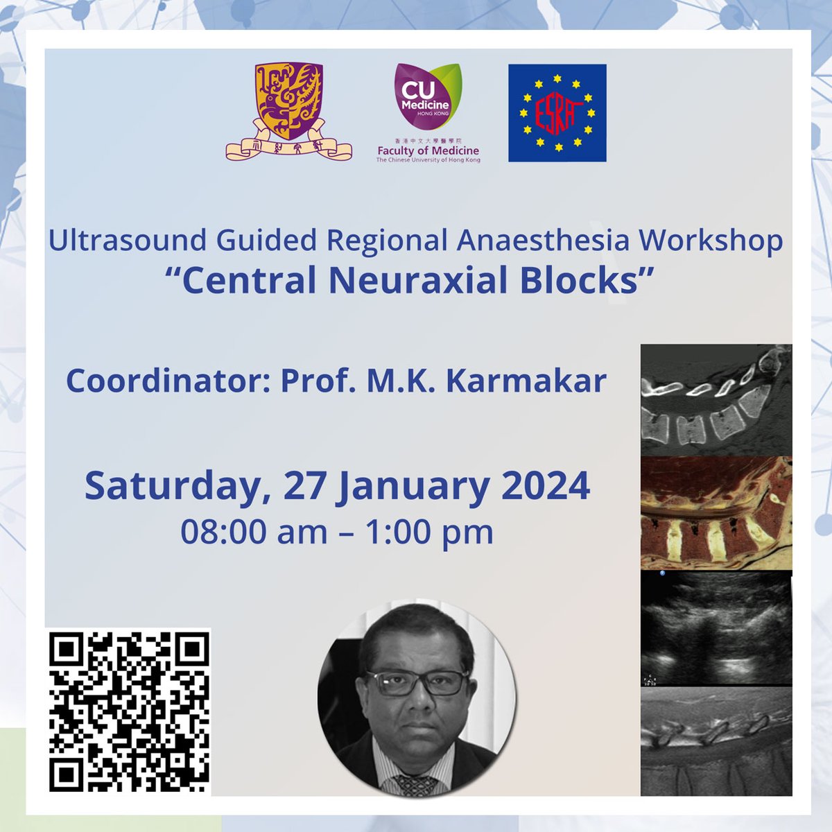 ESRA_Society's tweet photo. D-1 before the World Day 🌍 #WDRAPM
#HongKong is hosting a FREE webinar on Central Neuraxial Blocks for the occasion!
⌚ 8am-1pm local time
👉 https://t.co/VylDnjyX4o
Zoom ID: 916 7406 1649
Passcode: 202401
Thank you to Prof M.K. Karmakar for this great initiative 👏 https://t.co/blp5zUhrqK