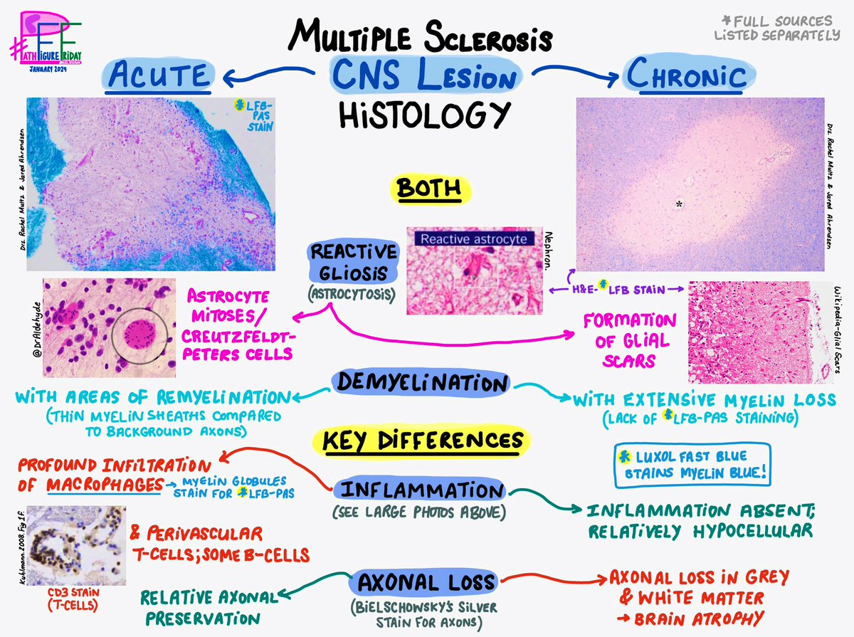 alex_tatarian's tweet photo. It’s #PathFigureFriday! 🧠 Here I share diagrams for concepts I’m learning. Please add any comments, corrections, or creations of your own!

#PathTwitter #PathX #MedX #MS #MultipleSclerosis #Neurology 
#NeuroPath #MedTwitter 

⬇️More:
https://t.co/Xme45LAw6F https://t.co/kCVLVUu2wb