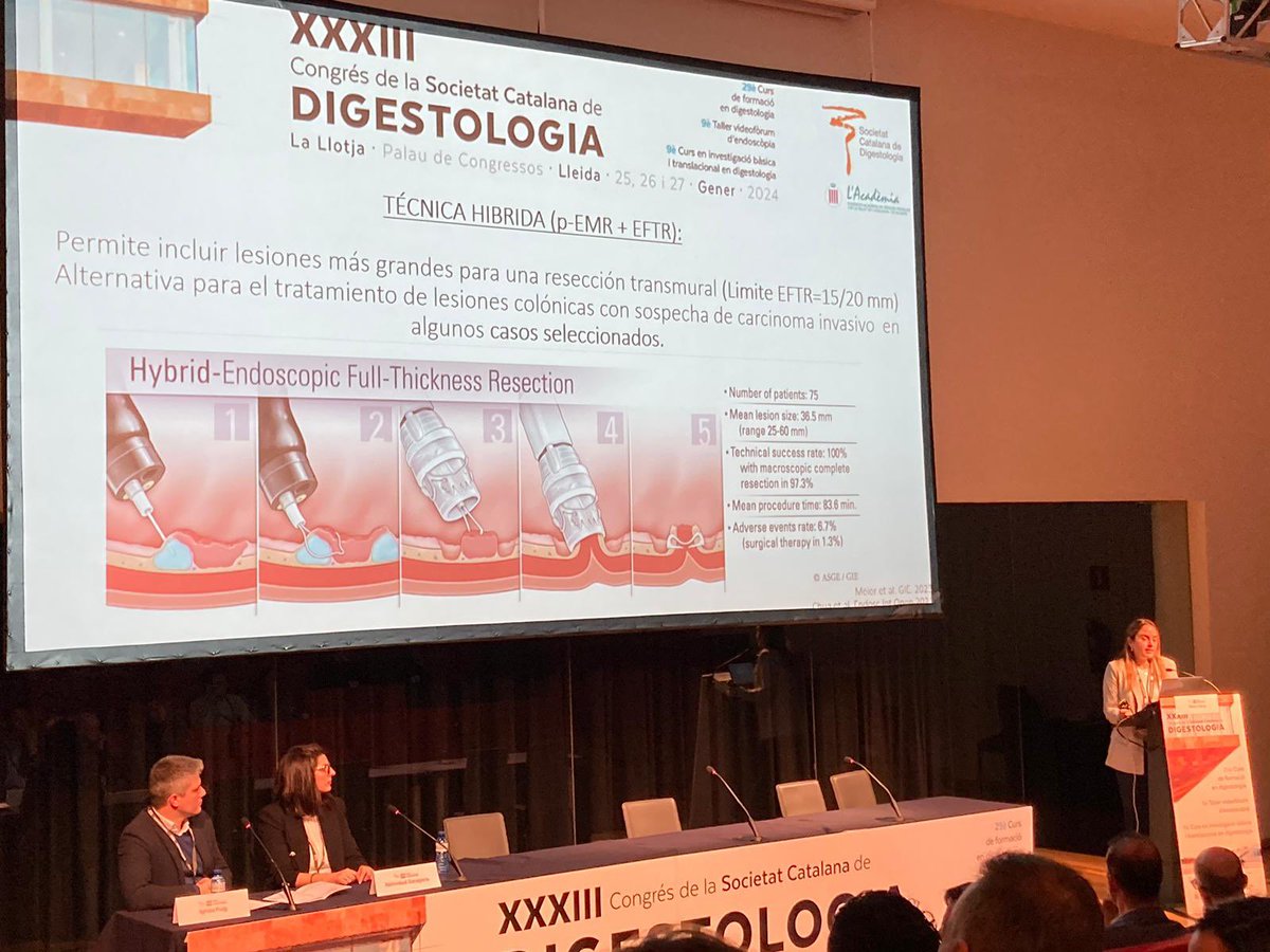 Maria Daca Alvarez (@merydacaalvarez) on Twitter photo Videoforum #SCDIGESTIU24 <a href="/SCDigestologia/">SCDigestologia</a>
Hybrid endoscopic full-thickness resection
<a href="/OGIPclinic/">Gastrointestinal and Pancreatic Oncology Team</a> <a href="/gasclinicbcn/">Servei Gastroenterologia Hospital Clínic Barcelona</a> Videoforum #SCDIGESTIU24 <a href="/SCDigestologia/">SCDigestologia</a>
Hybrid endoscopic full-thickness resection
<a href="/OGIPclinic/">Gastrointestinal and Pancreatic Oncology Team</a> <a href="/gasclinicbcn/">Servei Gastroenterologia Hospital Clínic Barcelona</a>