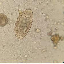 Microbiología Clínica La Paz 🏥 tweet media