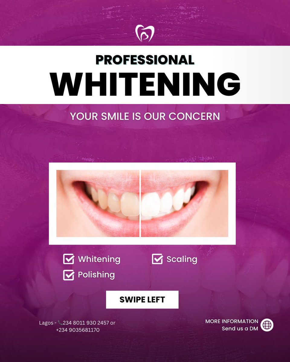FaeLifestyle's tweet photo. Results we love to see! 🥰 Our client here did scaling and polishing, teeth whitening.

PRICE: 1 hour package #40,000 Naira, 1 hour 30mins package #60,000 Naira

Scaling and polishing Range from 30k to 50k
#dentalcare #scaling #teethwhitening #laser https://t.co/NWBcVyJZkQ