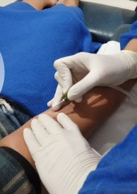 AfricanAFRAN's tweet photo. 📢Monthly AFRAN Nephrology Tweetorial: this tweetorial is created by @Gawad_Nephro , a member of @AfricanAFRAN Web &amp; Media Committee.
*AVF First Use (Cannulation)* https://t.co/5FLdasGAwf