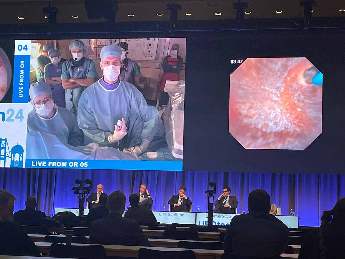 vdconinck's tweet photo. Humbled and honored to have performed live #RIRS in Vienna with the excellent team of @SEITZ_C_C during @urotech24 moderated by @scoffonecesare 
Thank you for the opportunity @AliSerdarGozen @AlbertoBreda1 @SelcukSilay @UrowebESU @eauesut @UrowebESU @EAUYAUrology @CP_Endourology https://t.co/uiGgl9uhXG