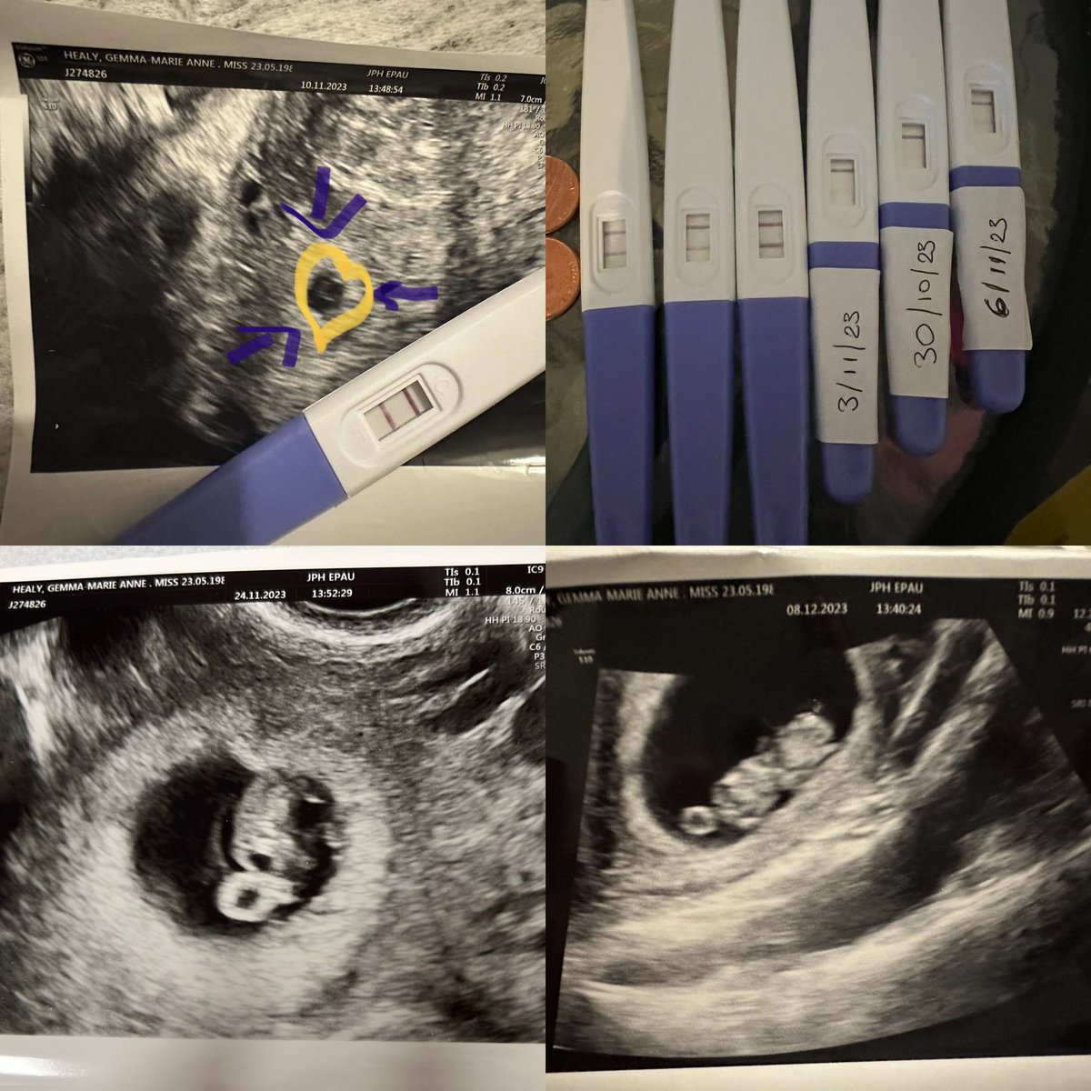 Healy2G's tweet photo. Can’t wait for gender date soon https://t.co/w4pMOKYkAb