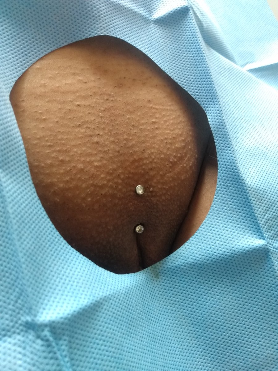 LimaSatine's tweet photo. Christina piercing com jóia de titânio e cristais.

#christinapiercing #piercingintimo https://t.co/qC4gfJZPbV