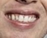 flatheadfarang's tweet photo. @Daniel__Street https://t.co/V2lCEwekuJ