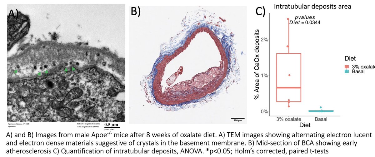 Moving from association to causation - Synchronous development of urolithiasis and enhanced atherosclerosis under oxalate challenge in a dyslipidemic model - Poster session at ROCK Meeting 2024 in Minneapolis #ROCKsociety #umn #oxalatefortwo