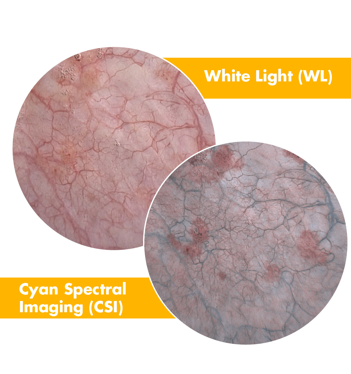 Introducing SPY Cyan Spectral Imaging (CSI)! This advanced imaging modality enhances the visualization of vasculature on the mucosal surface in urology procedures by emitting only green & short blue wavelengths. Learn more bit.ly/3RkLMuQ #1788Platform #SPYCSI