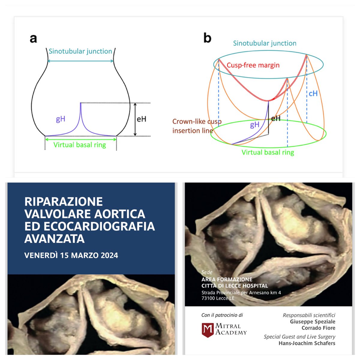 💡The 10 Commandments for Aortic Valve Repair ✅Do not miss our next meeting organized in “ Città di Lecce Hospital ”, 15 March 2024, that will cover all the echocardiographic and surgical aspect about aortic valve repair. Live surgery with Prof @schaefers_hans and GE workshop…