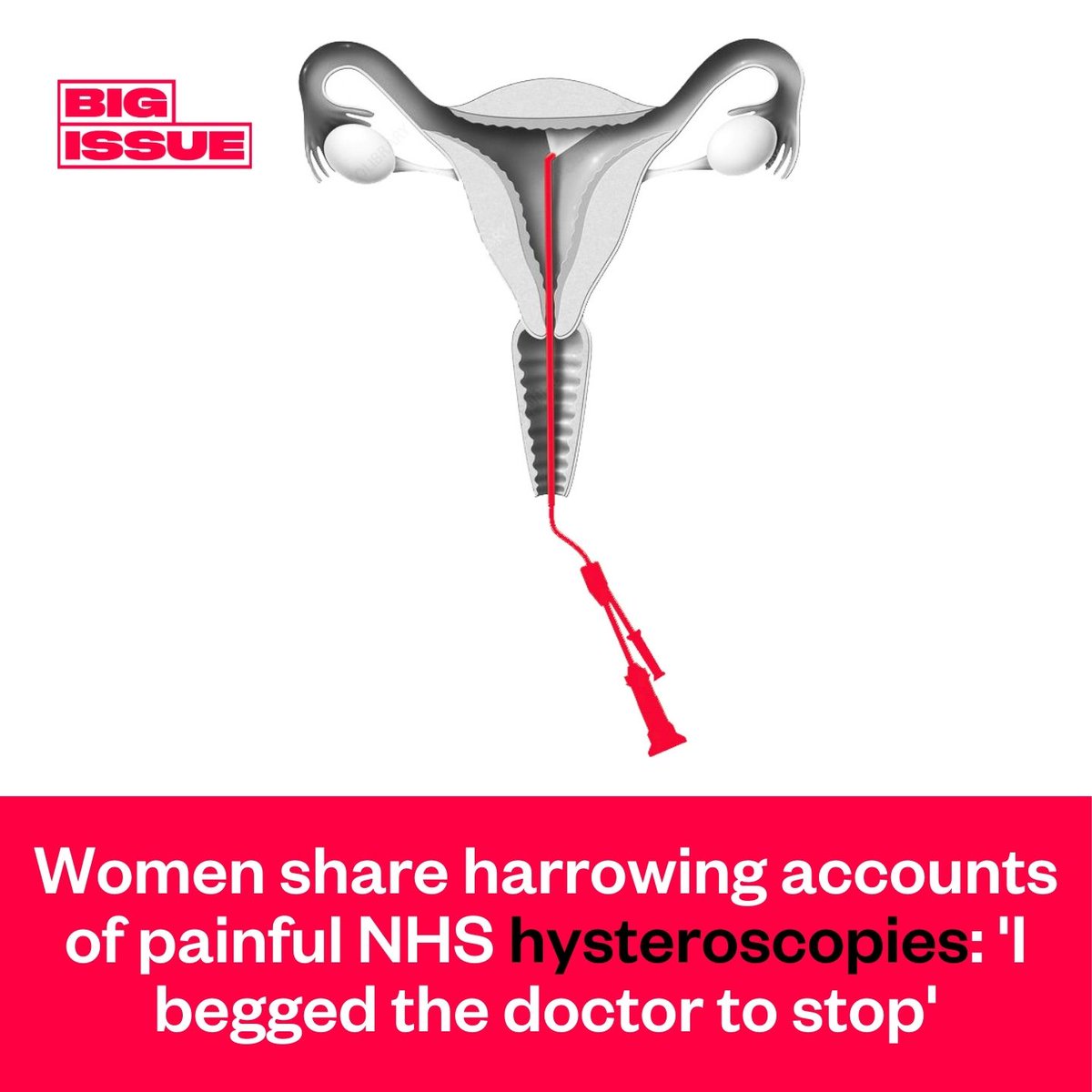 'You still feel like you’ve been lied to, treated like a farm animal and denied any kind of pain relief.' Two weeks ago we published an investigation into the pain many women face when undergoing hysteroscopies. Here are some of your responses ⤵️ bigissue.com/news/activism/…