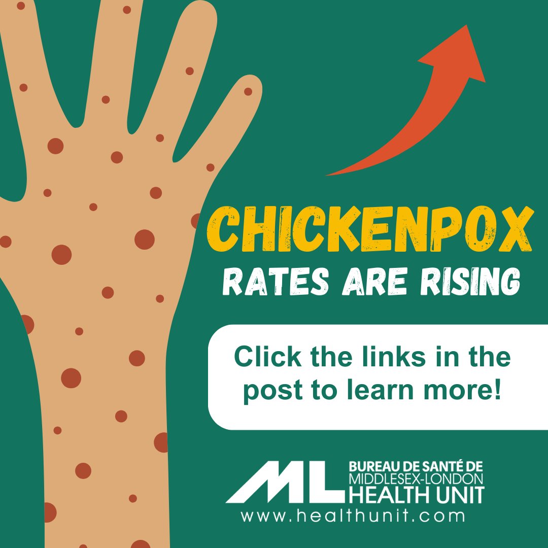 MLHealthUnit's tweet photo. Attention residents of London and Middlesex County! Varicella-zoster virus cases, commonly known as chickenpox, are on the rise in our community.

The #MLHU is recommending those who have not received the chickenpox vaccine nor had chickenpox in the past, to talk to a Health Care Provider about vaccination. You can only catch chickenpox once (unless immunocompromised), so if you’re unsure, talk to your Health Care Provider, search your vaccine records on ICON, or ask a parent to see if they have any of those chickenpox snapshots from your younger days.
.
.
1/2