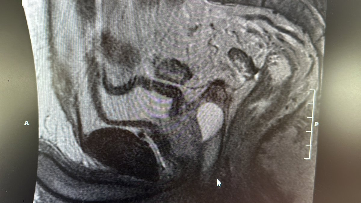 Daniel D Eun MD tweet media