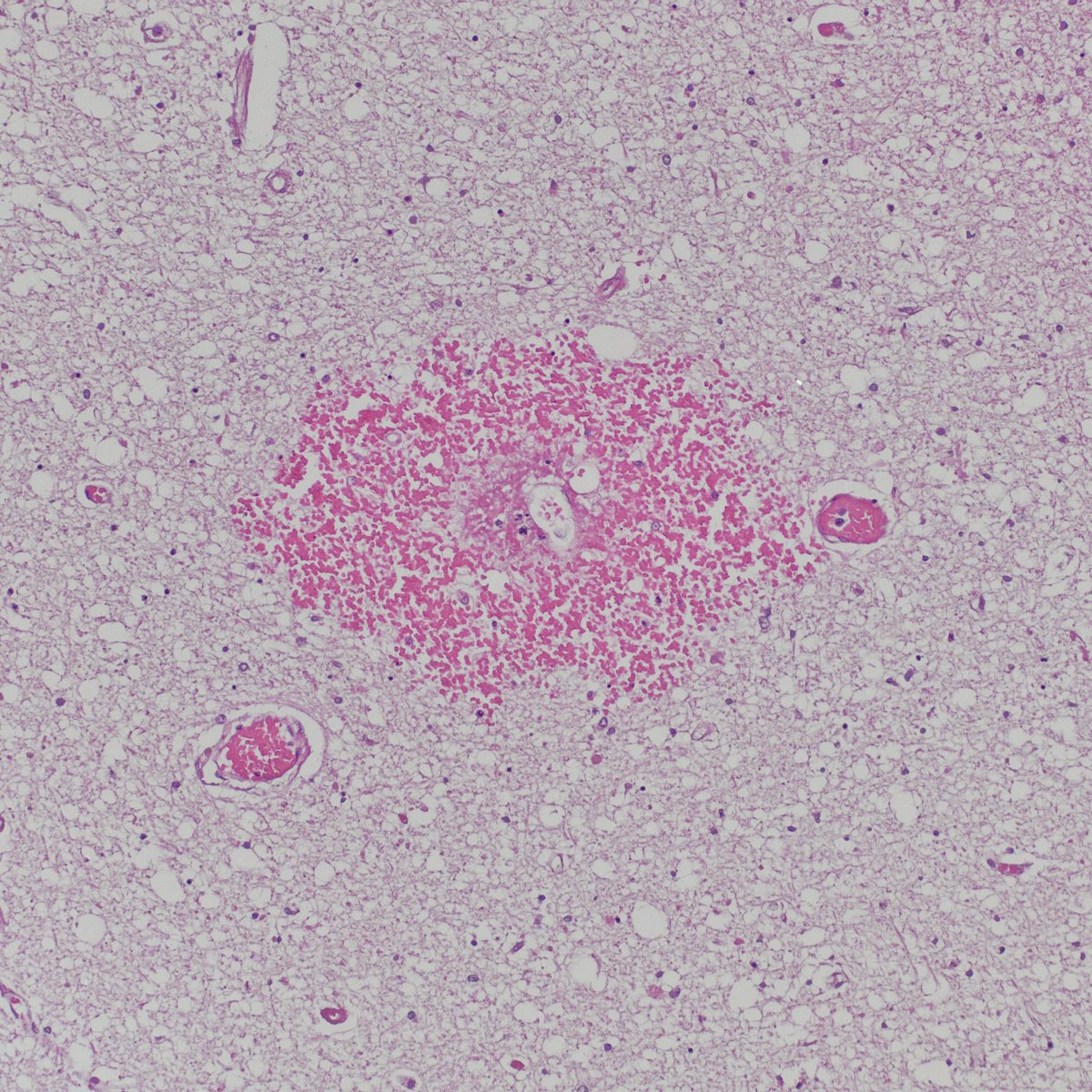 Kate Krause tweet media