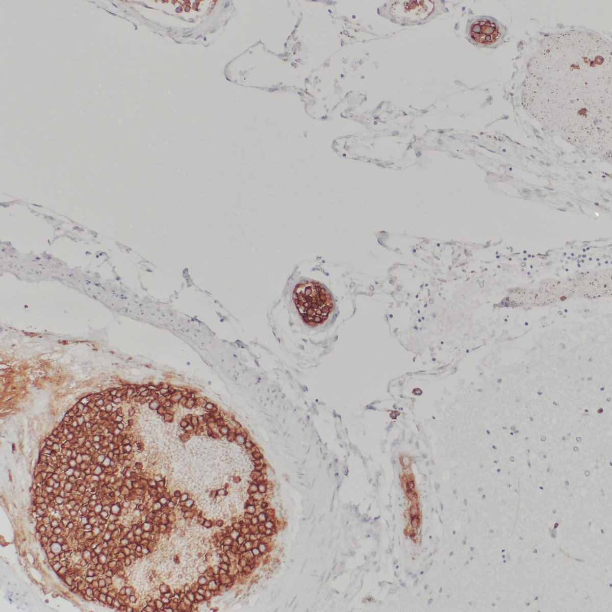 Kate Krause tweet media