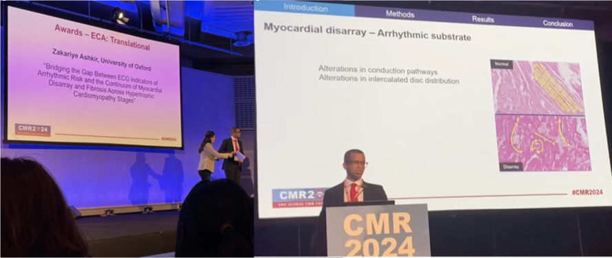 Many congrats @Z_Ashkir for winning the CMR 2024 ECA translational award. This is a really proud primary supervisor moment. Thank you to the @TheBHF @SCMR and special thanks to @RinaAriga and Liz Tunnicliffe for the original ground work in this space.