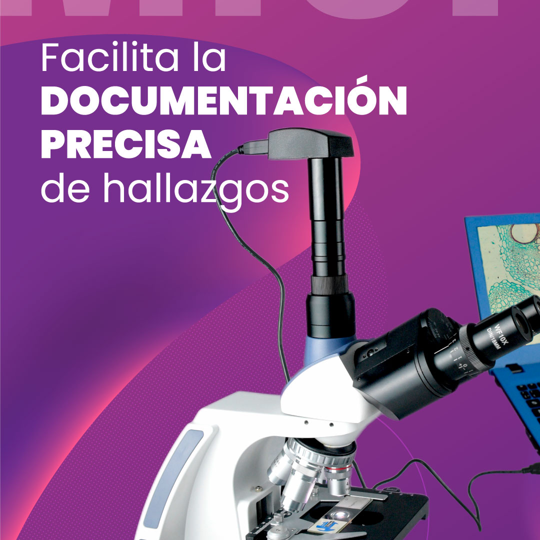 zeigenmx's tweet photo. Incorporar una cámara a tu equipo de laboratorio amplía las posibilidades de observación. Captura tus hallazgos de forma nítida y detallada con una cámara como PROCAM-5. Conoce más en: https://t.co/m1oedqWXB4 #Camara #Microscopia #MicroscopioBiologico #MicroscopioDigital https://t.co/GePQJa1RxZ