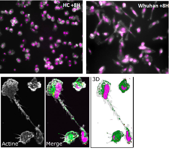 images de macrophages, macrophages avec tunnels