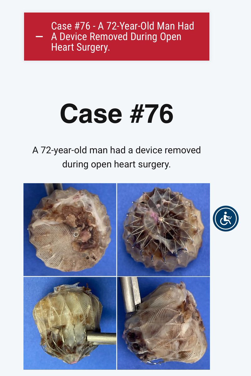 New Case of the Month(ish)!

Check it out here:

scvp.net/scvp-unknown-c…
