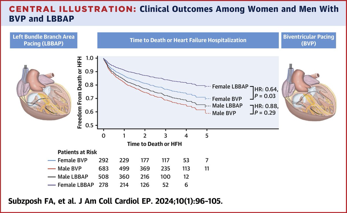 Cardiac resynchronization therapy using biventricular pacing has been associated w/ greater clinical improvement. Does the mode of CRT as in LBBAP confer greater benefit in outcomes related to #heartfailure, as compared to BVP among the sexes? bit.ly/3vR7Pkk #JACCCEP