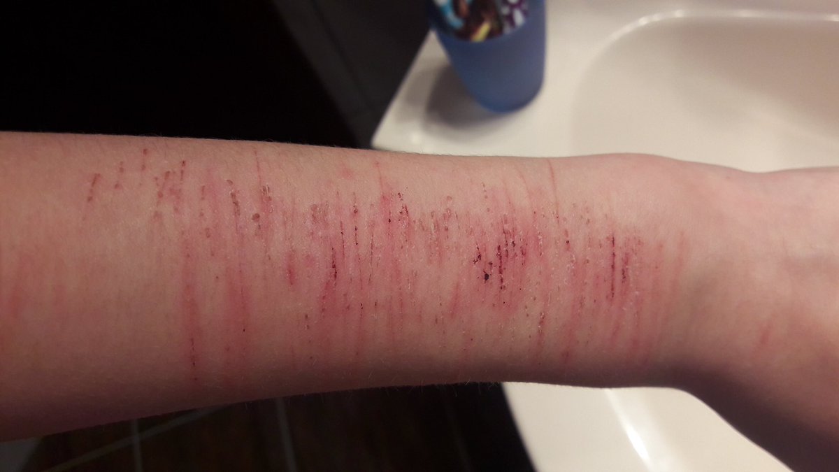 lauferMissil's tweet photo. just found my first cvts ever??? Holy shit I’ve never realized how bad it’s gotten over the years https://t.co/ptf6qFzacb