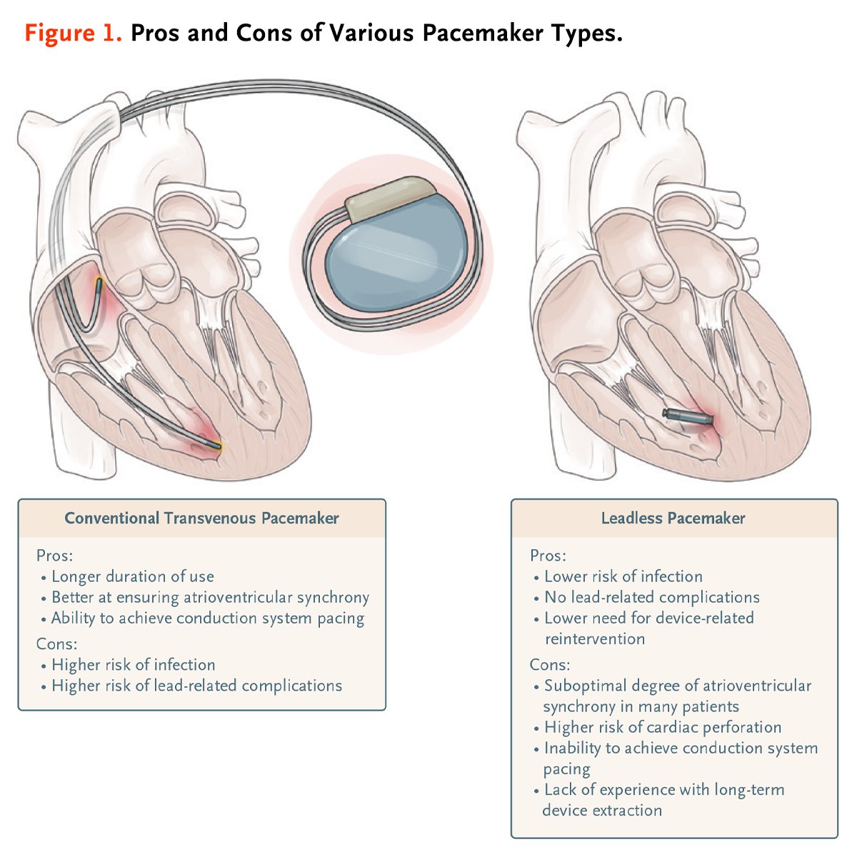 NEJM's tweet photo. This week’s most shared articles:  

1. Review Article: Cardiac Implantable Electronic Devices https://t.co/iW02BnhjaD #Cardiology https://t.co/4NmjABLKKo