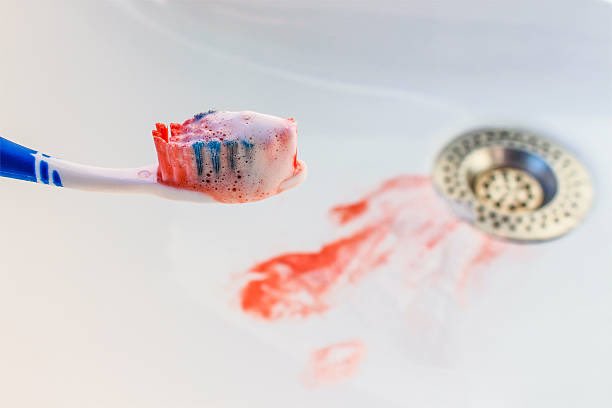 Some of you brush your teeth like you’re washing gutter, that’s why your gums keep bleeding when you brush. 

But what other habits can make your gums bleed when you brush? 

Read and share with your neighbour 👇