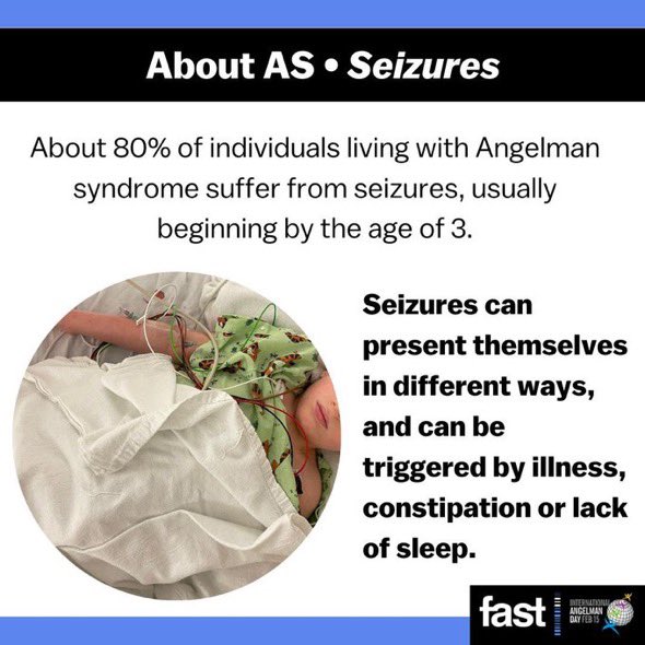 TeamSean24_Gib's tweet image. 15th February is International #AngelmanSyndrome Day, so here’s todays awareness info 💪💪 I’m in that 80%, but my seizures started when I was 14 months old &amp;amp; I’ve been on 💊 ever since  #ForwardAlwaysForward