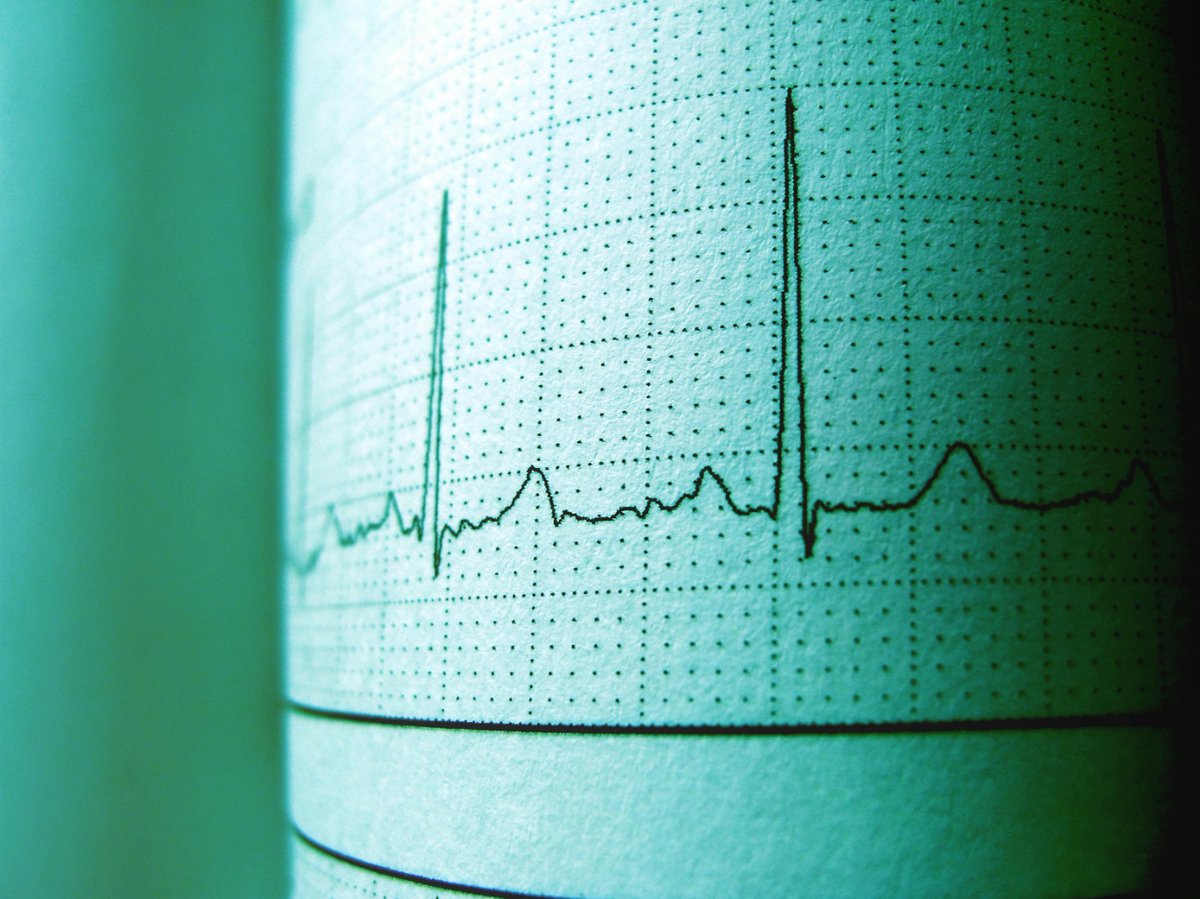HeartlineUK's tweet photo. CHD is a lifelong condition. Regular medical follow-ups and adapting to health needs are part of the journey. Read personal stories: https://t.co/BVn9a3CV8p https://t.co/FngT3CDON7
