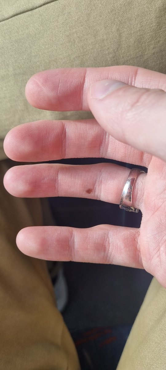 lil_vodku's tweet photo. Já jak neustále mám malíček pod mobilem, tak už tam mám z něj jamku, kam přesně fitne💀 https://t.co/tTu4dmD47r