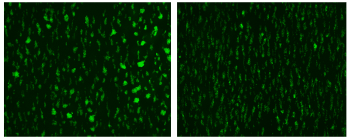 MMU Thrombosis Research Group (@mmu_thrombosis) on Twitter photo #Thrombosis #Thursdays!
We've been investigating the anti-thrombotic and prothrombotic properties of our drug panels, using our in vitro flow platform and our <a href="/LogosBiosystems/">Logos Biosystems</a> Celena S Digital Imaging system!
<a href="/MMU_Research/">Research & Innovation at Manchester Met</a> <a href="/MMU_LifeScience/">ManMet Life Sciences</a> <a href="/mmucvrg/">MMU Cardiovascular Research Group</a> <a href="/MMUEngage/">Manchester Met Science and Engineering</a> #Thrombosis #Thursdays!
We've been investigating the anti-thrombotic and prothrombotic properties of our drug panels, using our in vitro flow platform and our <a href="/LogosBiosystems/">Logos Biosystems</a> Celena S Digital Imaging system!
<a href="/MMU_Research/">Research & Innovation at Manchester Met</a> <a href="/MMU_LifeScience/">ManMet Life Sciences</a> <a href="/mmucvrg/">MMU Cardiovascular Research Group</a> <a href="/MMUEngage/">Manchester Met Science and Engineering</a>