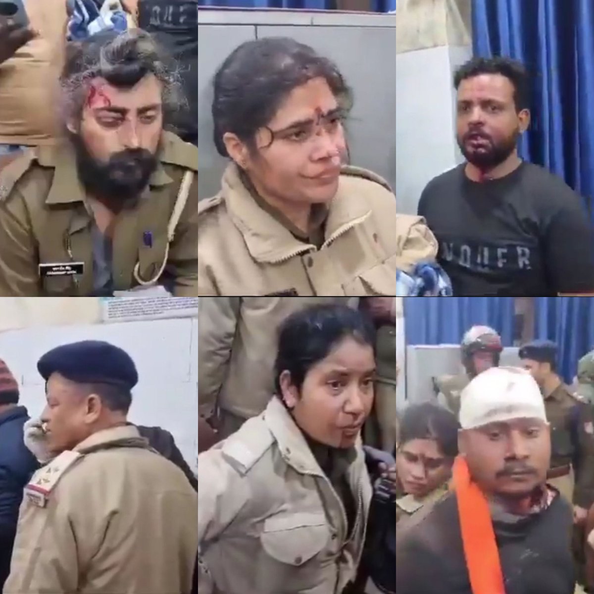 ये कुछ पुलिस वालों की तस्वीरें हैं… जो उत्तराखंड के हलद्वानी में कट्टरपंथी भीड़ के हमले में घायल हो गए है 🙏 हलद्वानी के बनभूलपुरा इलाके में प्रशासन द्वारा एक अवैध मदरसे को ध्वस्त करने जाने पर कट्टरपंथियों ने पथराव किया और वाहनों में आग लगा दी। #Haldwani