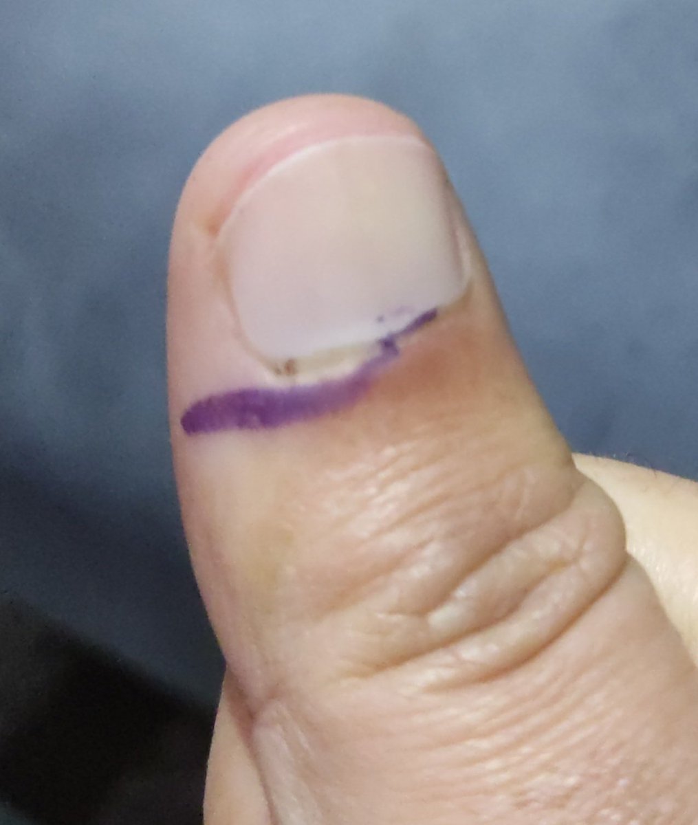 MAhmadButt1's tweet photo. Voted. Turnout is humongous but the voting process is purposefully sluggish.
@iqrarulhassan
@xadeejourno
@HamidMirPAK
@tariqmateen
@iRaiSaqib
@adeelraja
@Ahmad_Noorani
#NA134
#PP182
#PakistanElection
#GeneralElectionN0W
#2024Elections
#2024Election
#Pakistan
#VoteForPakistan https://t.co/zofvTaZeRb
