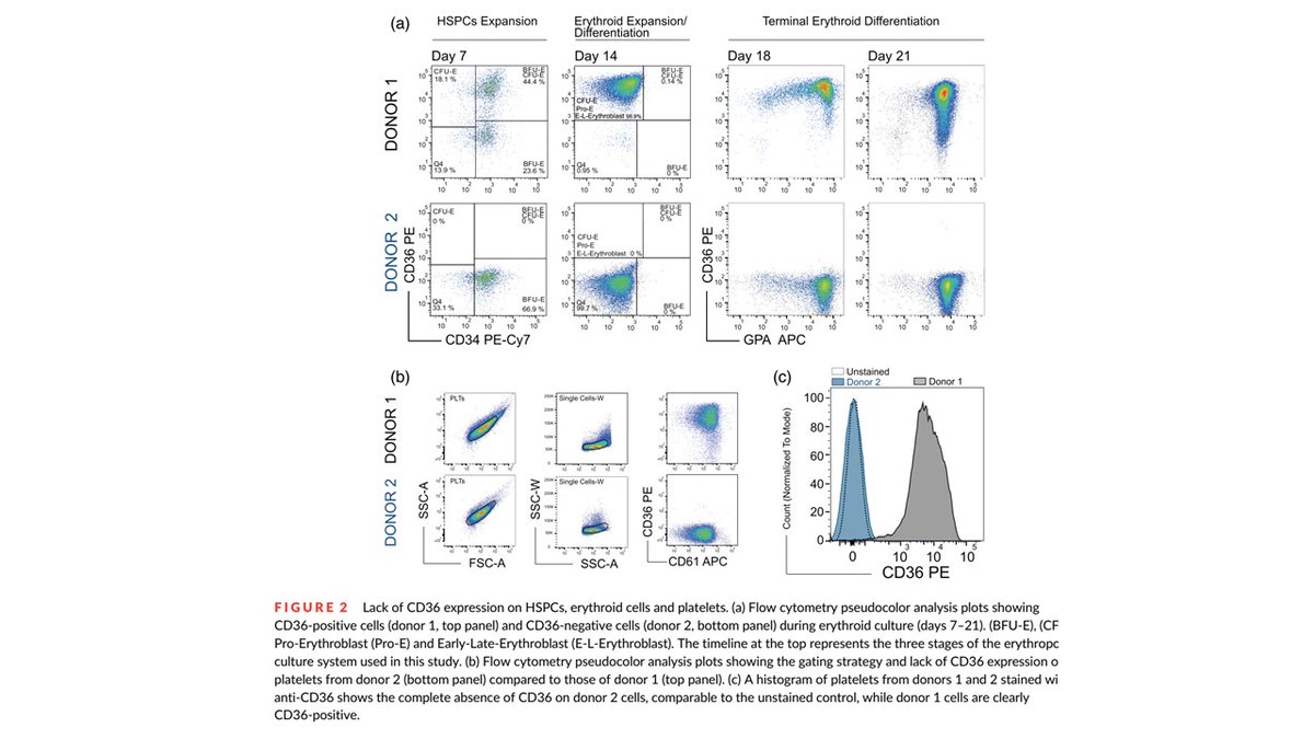 CzerwinsMarcin's tweet photo. Interesting paper explains why CD36 is a blood group antigen of clinical importance https://t.co/mqumsc3TB6

#blood_group https://t.co/CdZBHBUf62