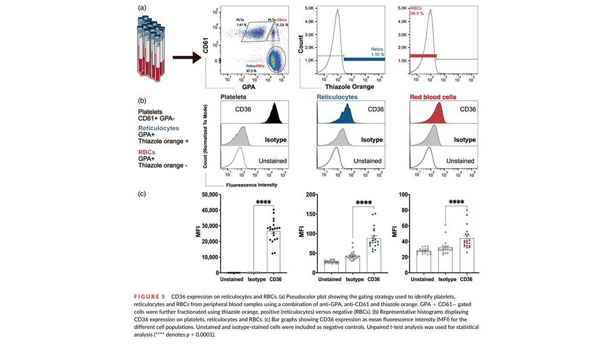 CzerwinsMarcin's tweet photo. Interesting paper explains why CD36 is a blood group antigen of clinical importance https://t.co/mqumsc3TB6

#blood_group https://t.co/CdZBHBUf62