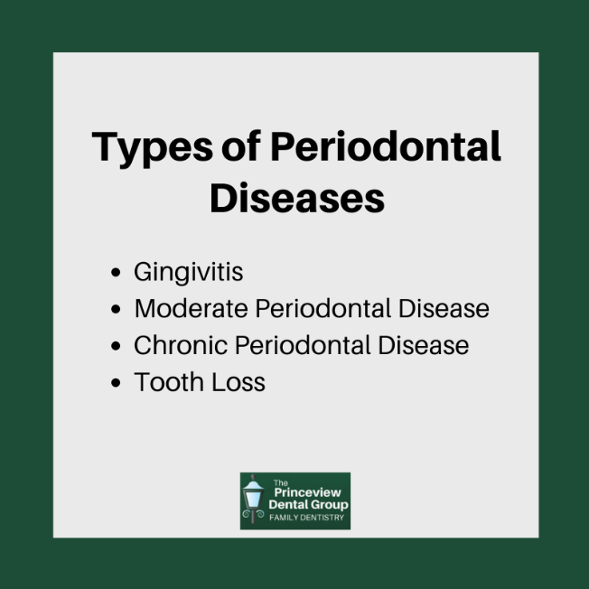PrinceviewD's tweet photo. #DentistInEtobicoke #OralHealth #TorontoDentist https://t.co/ihWvkpknB1