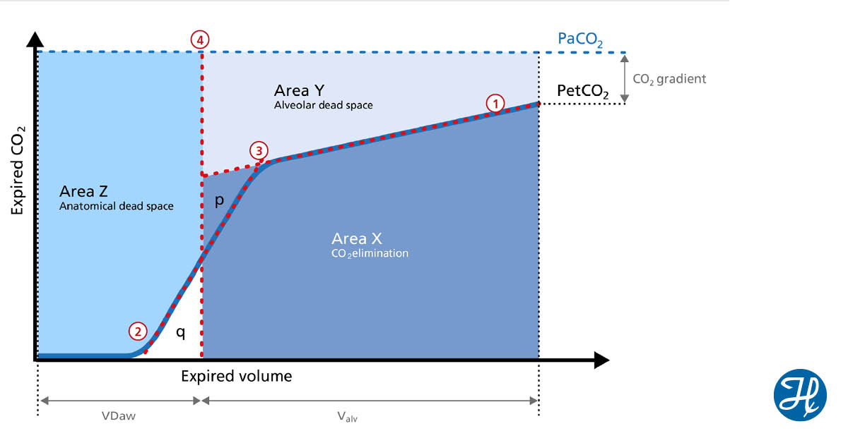 Ever wondered how understanding anatomical #deadspace, alveolar dead space, and #CO2elimination can provide crucial insights into a patient's lung condition? 
Learn more in the 2nd article about the Basics of #VolumetricCapnography: okt.to/JQ0GCE
#RespiratoryTherapy