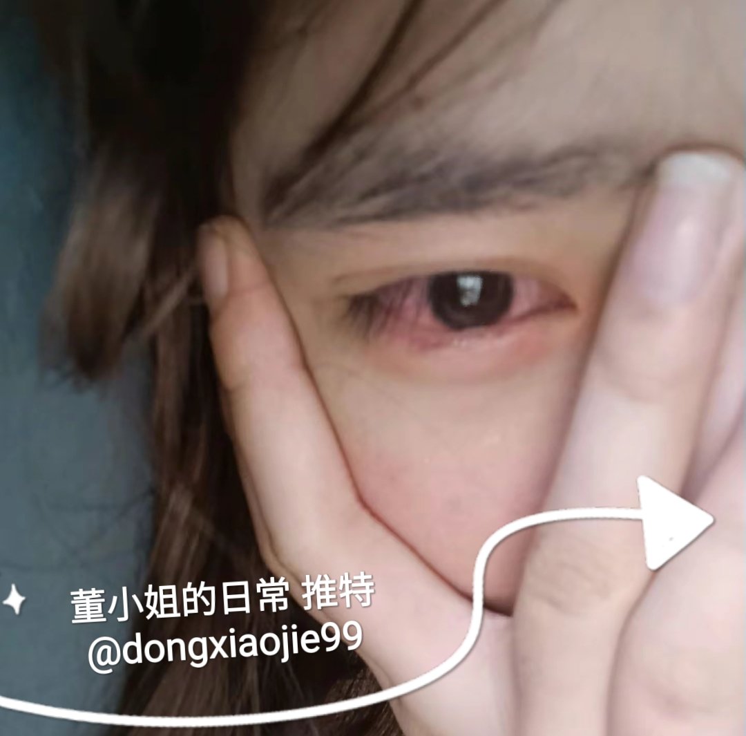 分手+发烧，我他妈痛不欲生的时候，一想到老六和美工婊一起过年打新年炮的样子，我就不甘心的想哭啊 https://t.co/kiXrf5lytp