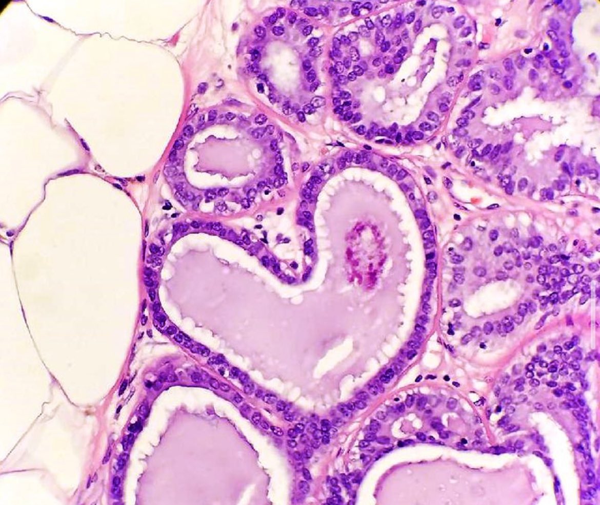 Katrina Collins, MD || Pathologist tweet media