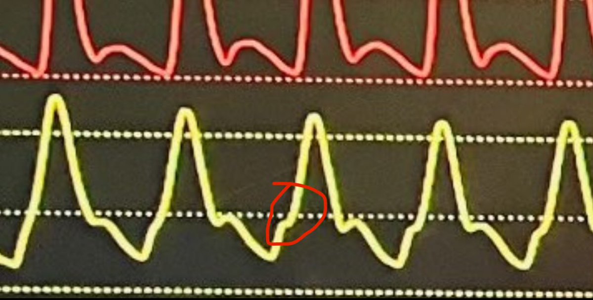 Jonathan Emling tweet media