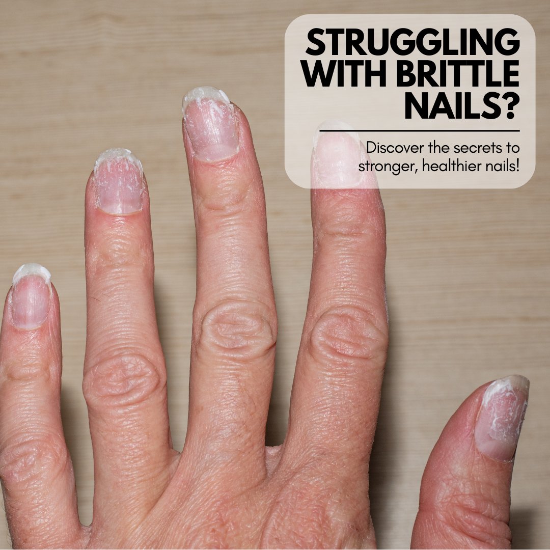 How to Make Nails Grow Faster: 9 Steps (with Pictures) - wikiHow