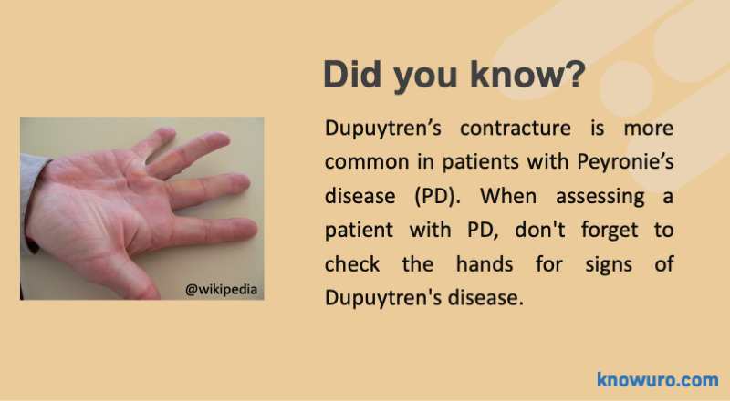 knowuro's tweet photo. Hello #urologists!

Do you usually check the hands of patients with Peyronie's Disease? Here is why...

#andrology #penilecurvature #urology https://t.co/fnhsVug6YP