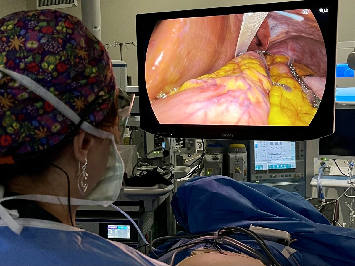 Alicia Pozo (@apozo_surgical) on Twitter photo 🔊Empezamos las Cirugías 3D en directo del curso #IMIS2024 con la Dra. <a href="/raquelsanchezdr/">Rsanchezsantos</a> operando una Gastrectomía vertical por puerto único con energía híbrida #Thunderbeat activando el modo #YellowEnhancement para visualizar mejor los nervios durante la cirugía #SeeTreatConnect 🔊Empezamos las Cirugías 3D en directo del curso #IMIS2024 con la Dra. <a href="/raquelsanchezdr/">Rsanchezsantos</a> operando una Gastrectomía vertical por puerto único con energía híbrida #Thunderbeat activando el modo #YellowEnhancement para visualizar mejor los nervios durante la cirugía #SeeTreatConnect