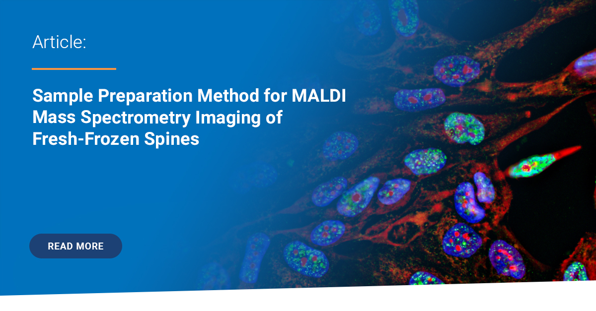 BrukerMassSpec's tweet photo. Expand your neuroscience-focused MALDI Imaging workflows to include decalcified fresh frozen spines with this new methodology for lipids: https://t.co/neButWP49k
@DrE_Neumann

#spatialbiology #neuroscience #maldiimaging https://t.co/3aT59A9zmy