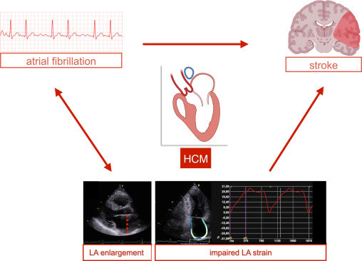 🫀 From atrial fibrillation management to atrial myopathy assessment: the evolving concept of left atrium disease in HCM @CJCJournals #cardioEd #Cardiology #CardioTwitter